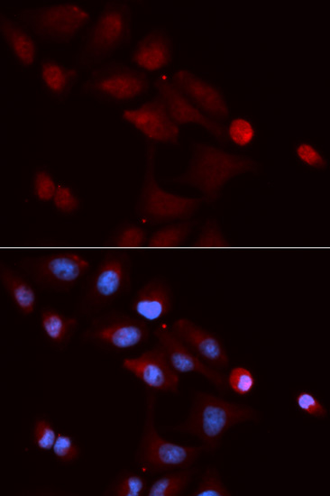 Anti-SNRPE Antibody (CAB5488)