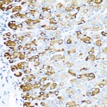 Anti-MGP Antibody (CAB5439)