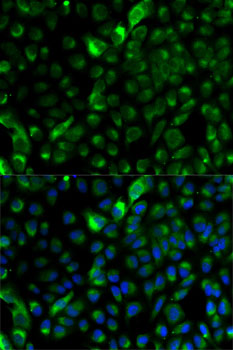 Anti-KRT17 Antibody (CAB2175)