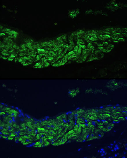 Anti-ALOX12 Antibody (CAB14703)