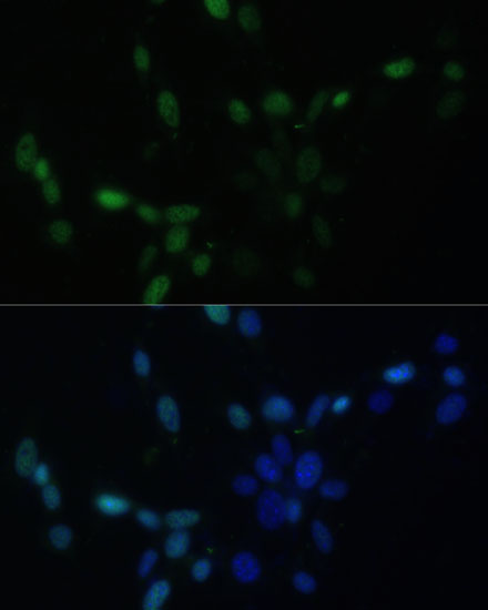 Anti-SMAD9 Antibody (CAB7518)