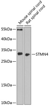 Anti-STMN4 Antibody (CAB3026)