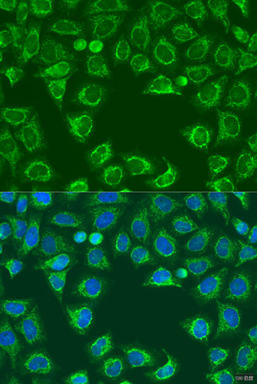 Anti-ALG2 Antibody (CAB15203)