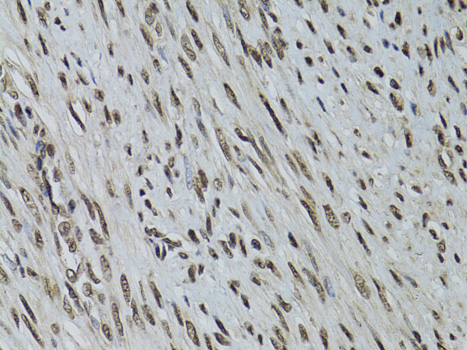 Anti-LKB1 Antibody [KO Validated] (CAB2122)