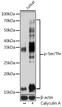 Anti-pan Phospho-Serine/Threonine Antibody (CABP1067)