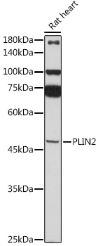 Anti-PLIN2 Antibody (CAB6276)