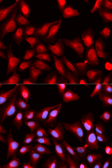 Anti-DDX5 Antibody (CAB5296)