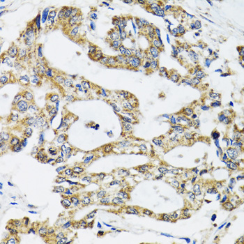 Anti-SSBP1 Antibody (CAB6987)