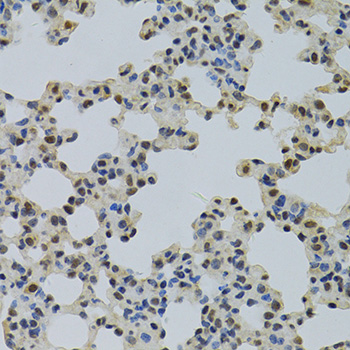 Anti-NLK Antibody (CAB3190)