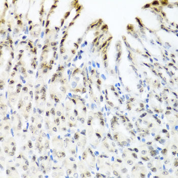 Anti-YTHDF3 Polyclonal Antibody (CAB8395)