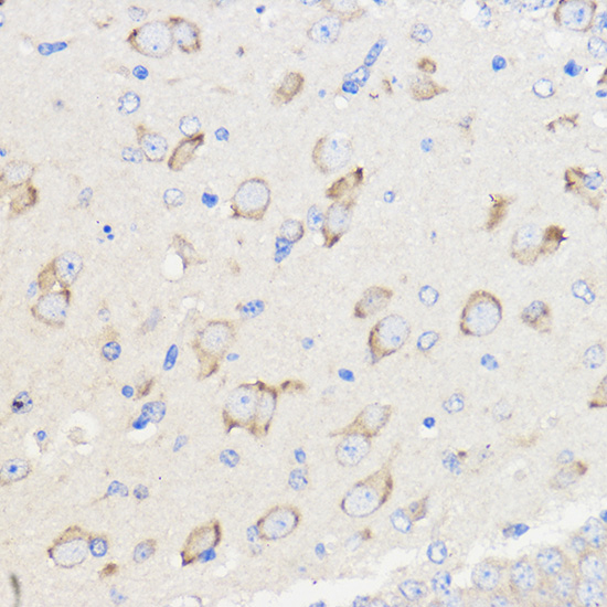 Anti-WBSCR27 Antibody (CAB16176)