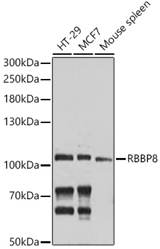 Anti-RBBP8 Antibody (CAB10201)