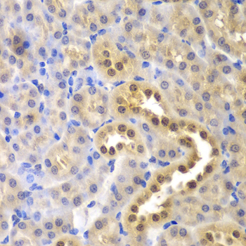 Anti-GLO1 Antibody (CAB1932)