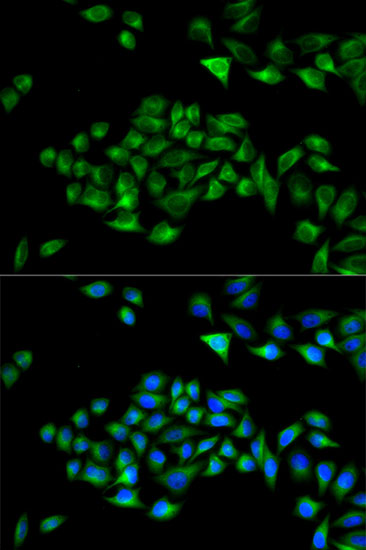 Anti-PCM1 Antibody (CAB16637)