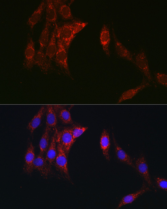 Anti-TOM20 Antibody [KO Validated] (CAB18047)