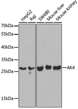 Anti-AK4 Antibody (CAB2050)