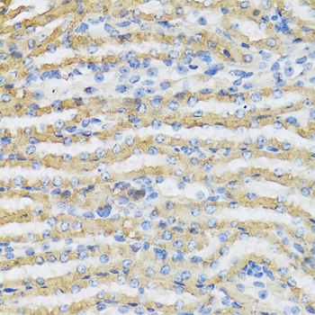 Anti-C4BPB Antibody (CAB6362)