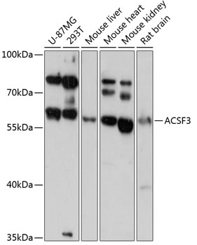 Anti-ACSF3 Antibody (CAB13769)