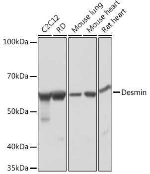 Anti-Desmin Antibody (CAB3736)