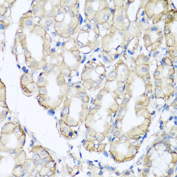 Anti-AHCYL1 Antibody (CAB7773)