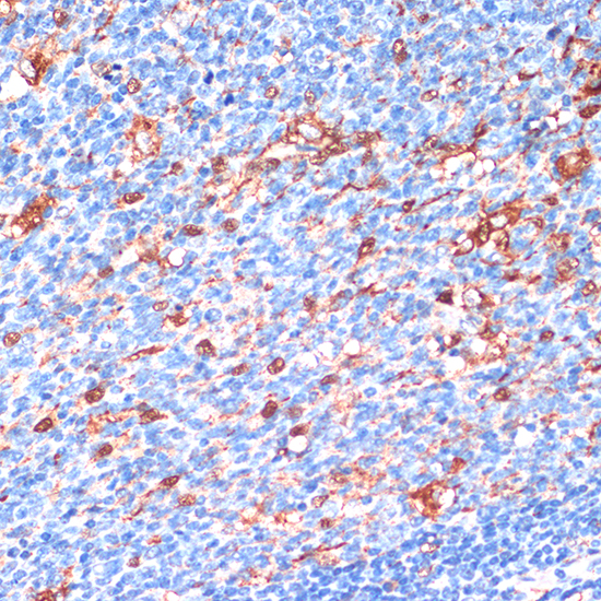 Anti-YWHAB Antibody (CAB1023)