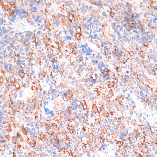 Anti-ACAT1 Antibody (CAB5335)