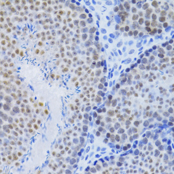 Anti-MCM4 Antibody (CAB3018)