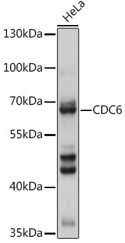 Anti-CDC6 Antibody (CAB18249)