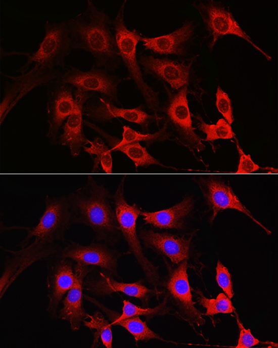 Anti-RAC1 Antibody (CAB7720)