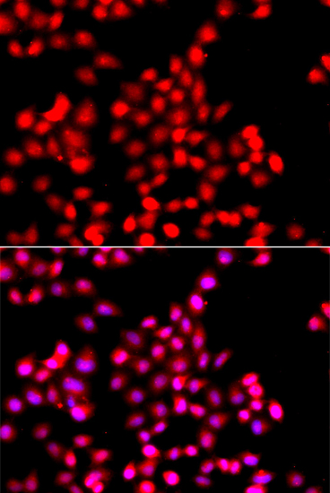 Anti-TTBK2 Antibody (CAB13448)