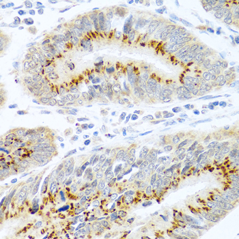 Anti-FAM3B Antibody (CAB1082)