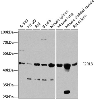 Anti-F2RL3 Polyclonal Antibody (CAB8471)