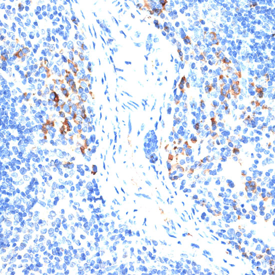 Anti-MMP9 Antibody (CAB0289)