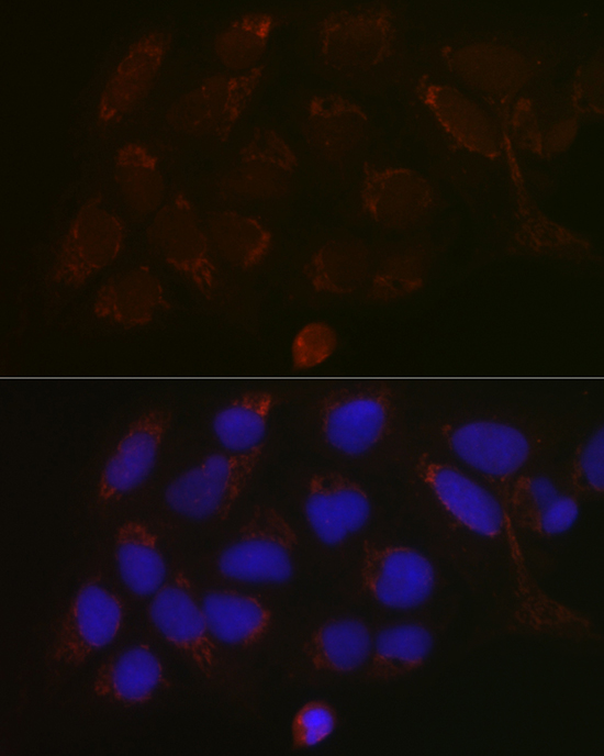 Anti-GALNT3 Antibody (CAB13985)