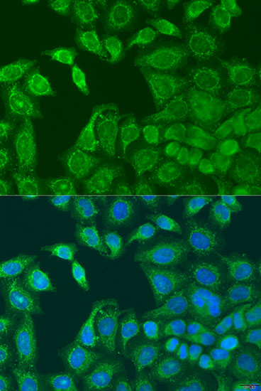 Anti-AANAT Antibody (CAB15016)