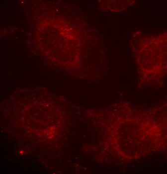 Anti-Phospho-GAB1-Y627 Antibody (CABP0256)