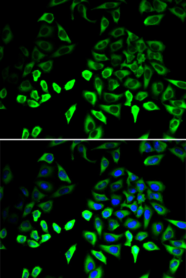 Anti-PKM Antibody (CAB0268)