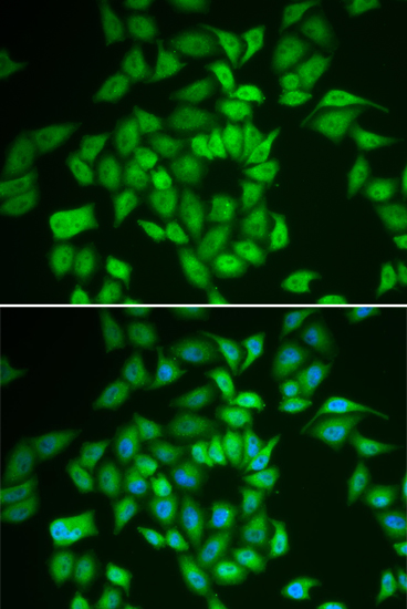 Anti-CSNK1E Antibody [KO Validated] (CAB1796)