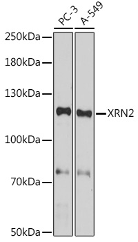 Anti-XRN2 Antibody (CAB18350)