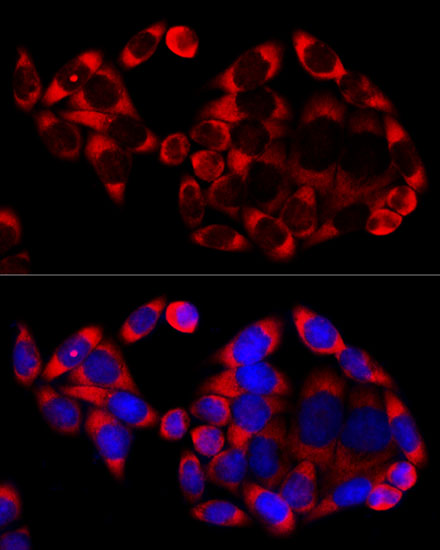 Anti-Cy3 Goat Anti-Rabbit IgG (H+L) Antibody (CABS007)