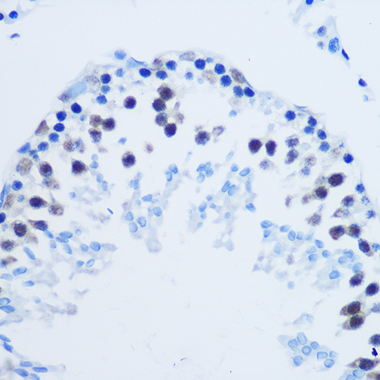 Anti-Asymmetric DiMethyl-Histone H3-R8 Antibody (CAB3157)