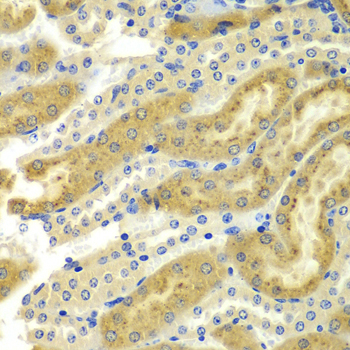 Anti-PAK2 Antibody (CAB7333)