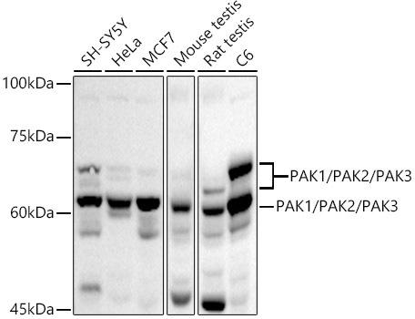 Western blot analysis of extracts of various cell lines, using PAK1/PAK2/PAK3 antibody at 1:1000 dilution. Secondary antibody: HRP Goat Anti-Rabbit IgG (H+L) at 1:10000 dilution. Lysates/proteins: 25ug per lane. Blocking buffer: 3% nonfat dry milk in TBST. Detection: ECL Basic Kit. Exposure time: 30s.