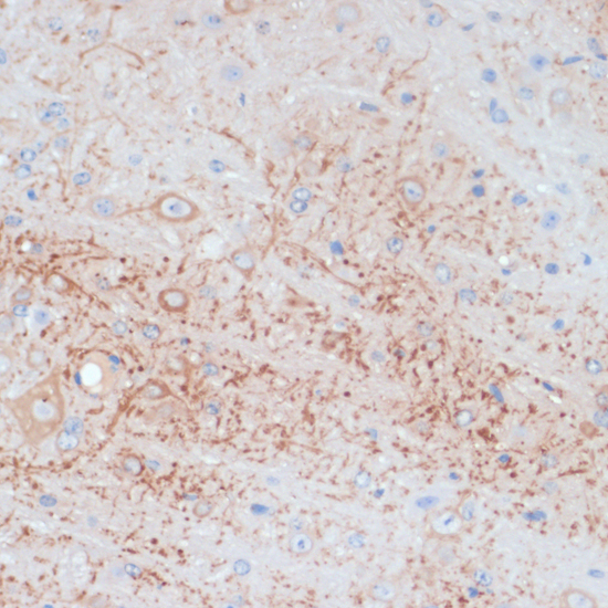 Anti-Map2 Antibody (CAB17409)