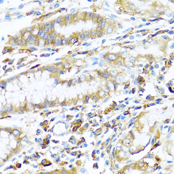 Anti-HLA-DPB1 Antibody (CAB1412)