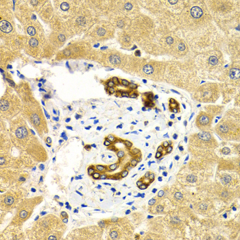 Anti-RAB27A Antibody [KO Validated] (CAB1934)