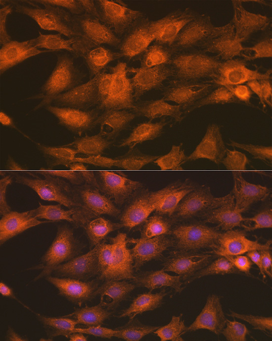 Anti-IKKGamma Antibody (CAB0917)