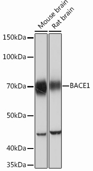 Anti-BACE1 Antibody