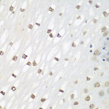 Anti-FOSL2 Antibody (CAB2729)