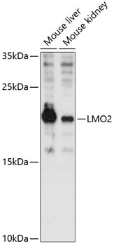 Anti-LMO2 Antibody (CAB12679)